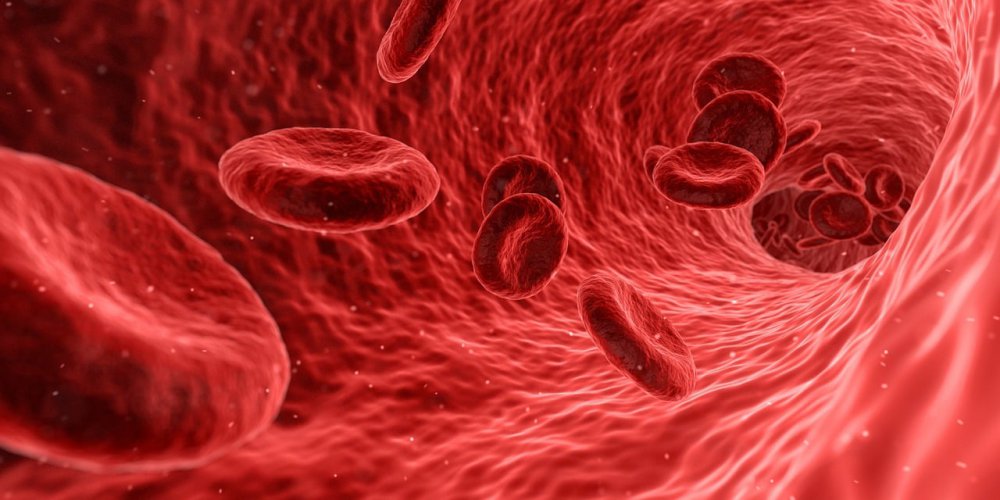 anemia